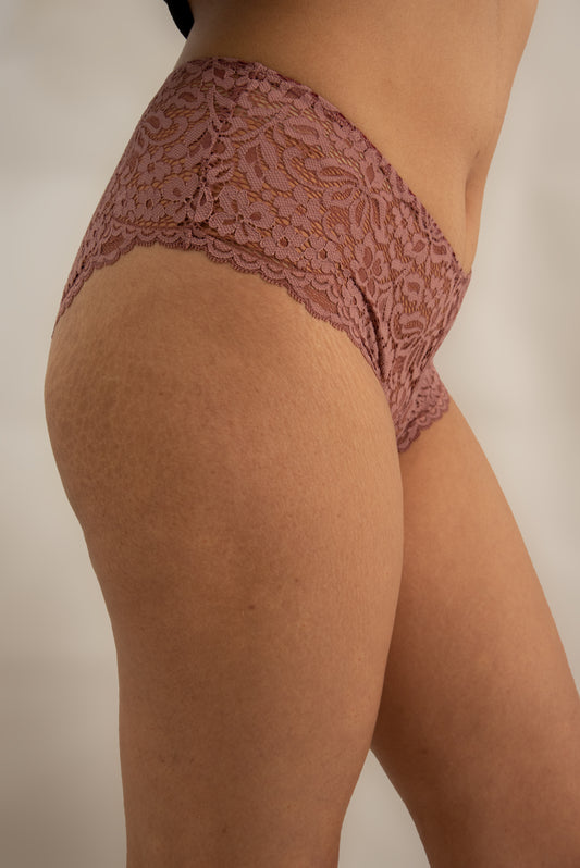 Snug Lace